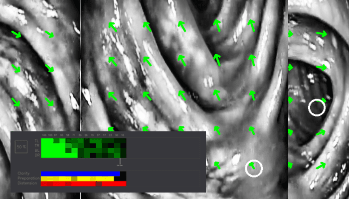 Endoscopy Quality Evaluation